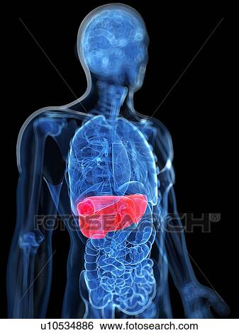 Stock Illustration - Liver cancer, artwork. Fotosearch