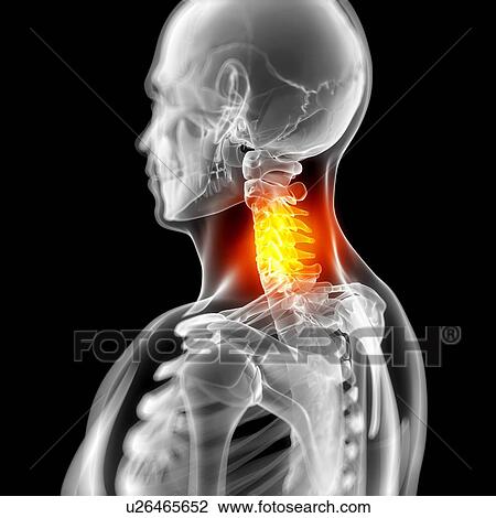 Neck pain, conceptual artwork View Large Illustration Drawing - Neck pain, conceptual artwork. Fotosearch