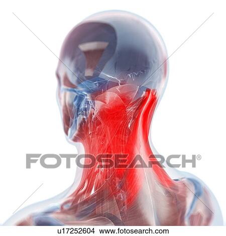 Stock Illustration - Neck pain, conceptual artwork. Fotosearch
