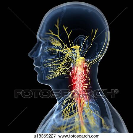 Neck pain, conceptual artwork View Large Illustration Stock Illustration - Neck pain, conceptual artwork. Fotosearch