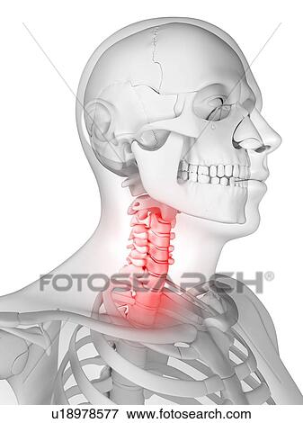 Neck pain, conceptual artwork View Large Illustration Stock Illustration - Neck pain, conceptual artwork. Fotosearch