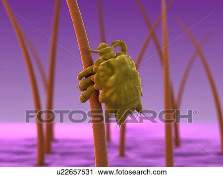 Clip Art - Pubic louse, artwork. Fotosearch