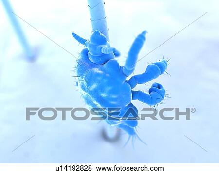Pubic louse, artwork View Large Illustration Stock Illustration - Pubic louse, artwork. Fotosearch