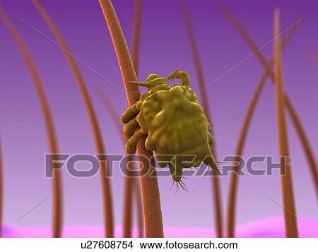 Pubic louse, artwork View Large Illustration Stock Illustration - Pubic louse, artwork. Fotosearch