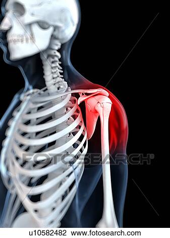 Shoulder pain, conceptual artwork View Large Illustration Drawing - Shoulder pain, conceptual artwork. Fotosearch