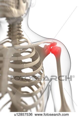 Shoulder pain, conceptual artwork View Large Illustration Stock Illustration - Shoulder pain, conceptual artwork. Fotosearch