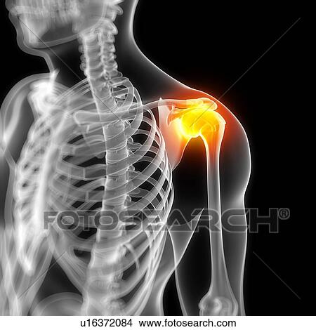 Shoulder pain, conceptual artwork View Large Illustration Stock Illustration - Shoulder pain, conceptual artwork. Fotosearch