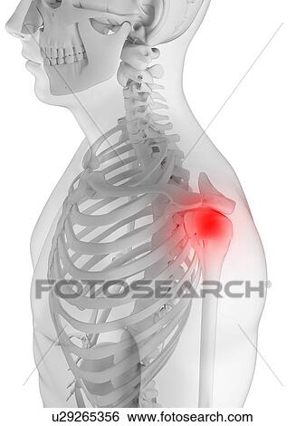 Shoulder pain, conceptual artwork View Large Illustration Stock Illustration - Shoulder pain, conceptual artwork. Fotosearch