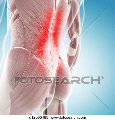 Back pain, conceptual artwork View Large Illustration Stock Illustration - Back pain, conceptual artwork. Fotosearch