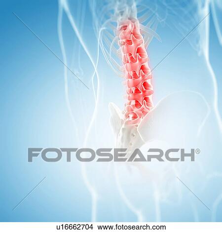 Back pain, conceptual artwork View Large Illustration Stock Illustration - Back pain, conceptual artwork. Fotosearch