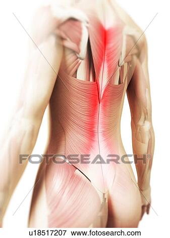 Back pain, conceptual artwork View Large Illustration Stock Illustration - Back pain, conceptual artwork. Fotosearch