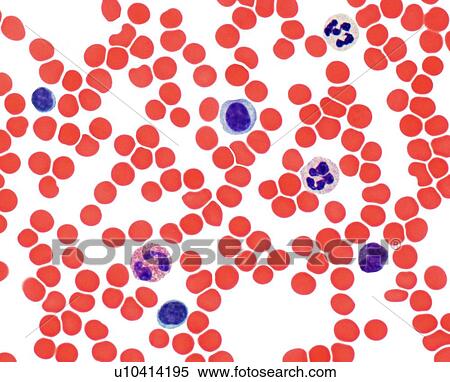 Blood smear, light micrograph View Large Illustration Stock Illustration - Blood smear, light micrograph. Fotosearch