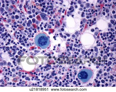 Clip Art - Bone marrow, light micrograph. Fotosearch