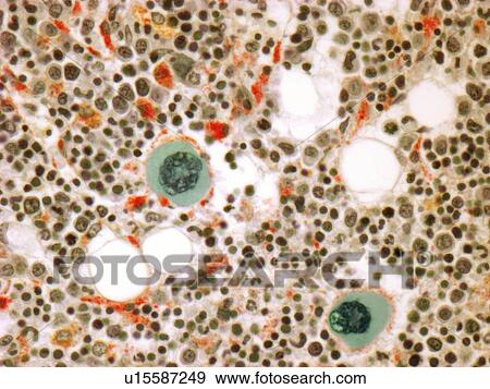 Stock Illustration - Bone marrow, light micrograph. Fotosearch
