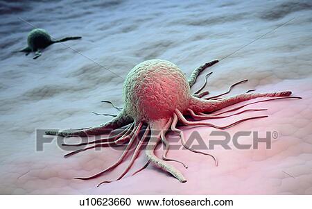 Clipart - Cancer cells, artwork. Fotosearch