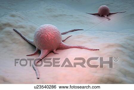 Cancer cells, artwork View Large Illustration Stock Illustration - Cancer cells, artwork. Fotosearch