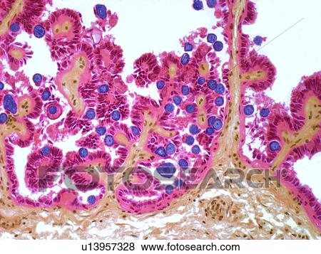 Coccidiosis, light micrograph View Large Illustration Stock Illustration - Coccidiosis, light micrograph. Fotosearch