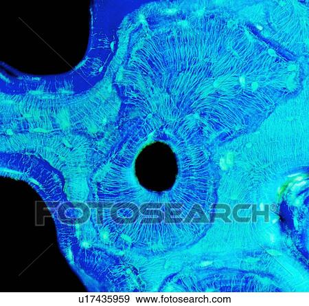 Compact bone, light micrograph View Large Illustration Stock Illustration - Compact bone, light micrograph. Fotosearch