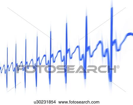 Stock Illustration - ECG, computer artwork. Fotosearch
