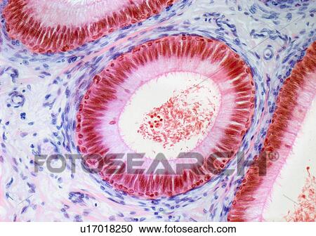 Clipart - Epididymis, light micrograph. Fotosearch