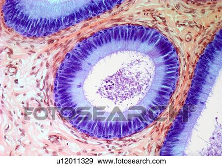 Stock Illustration - Epididymis, light micrograph. Fotosearch