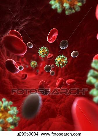 Stock Illustration - Foot and mouth infection, artwork. Fotosearch