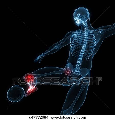 Football injury, artwork View Large Illustration Stock Illustration - Football injury, artwork. Fotosearch