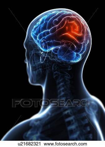 Clip Art - Headache, conceptual artwork. Fotosearch