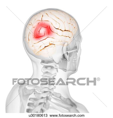 Headache, conceptual artwork View Large Illustration Drawing - Headache, conceptual artwork. Fotosearch