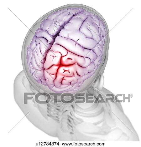 Headache, conceptual artwork View Large Illustration Stock Illustration - Headache, conceptual artwork. Fotosearch