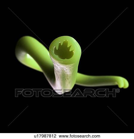Hookworm, artwork View Large Illustration Drawing - Hookworm, artwork. Fotosearch