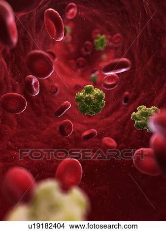 HPV infection, artwork View Large Illustration Stock Illustration - HPV infection, artwork. Fotosearch