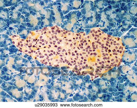Drawing - Islet of Langerhans, light micrograph. Fotosearch