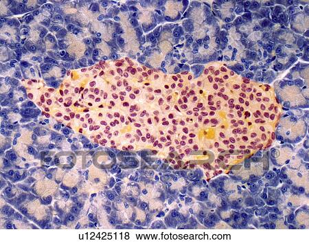 Stock Illustration - Islet of Langerhans, light micrograph. Fotosearch