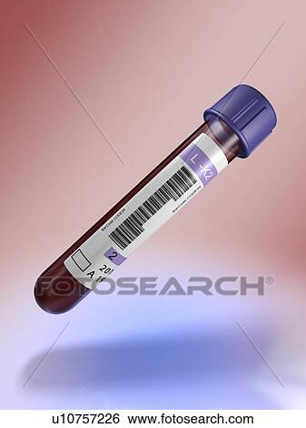 Stock Illustration - Medical test tube with blood, artwork. Fotosearch