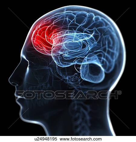 Migraine, conceptual artwork View Large Illustration Stock Illustration - Migraine, conceptual artwork. Fotosearch