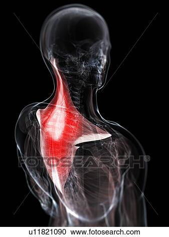 Neck pain, conceptual artwork View Large Illustration Clipart - Neck pain, conceptual artwork. Fotosearch