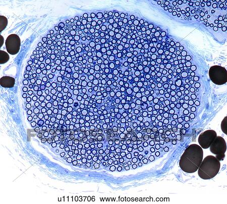 Nerve bundle, light micrograph View Large Illustration Stock Illustration - Nerve bundle, light micrograph. Fotosearch