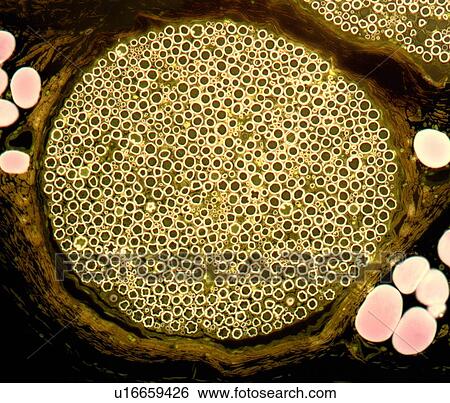 Stock Illustration - Nerve bundle, light micrograph. Fotosearch