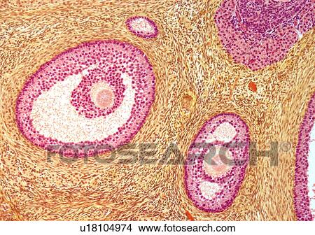 Stock Illustration - Ovarian follicles, light micrograph. Fotosearch