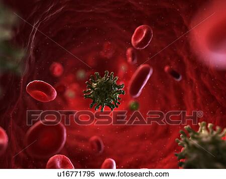 Polio infection, artwork View Large Illustration Stock Illustration - Polio infection, artwork. Fotosearch