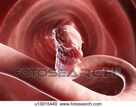 Clipart - Roundworm, artwork. Fotosearch
