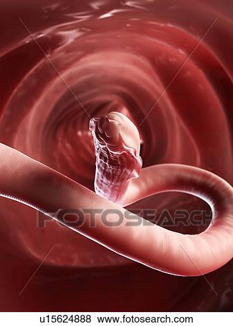 Stock Illustration - Roundworm, artwork. Fotosearch