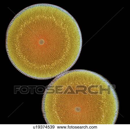 Roundworm ovaries, light micrograph View Large Illustration Stock Illustration - Roundworm ovaries, light micrograph. Fotosearch