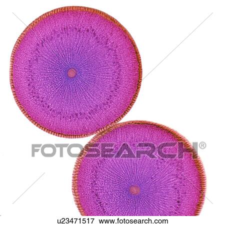 Stock Illustration - Roundworm ovaries, light micrograph. Fotosearch