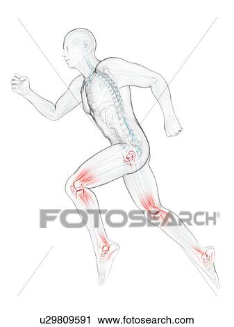 Clip Art - Running injuries, conceptual artwork. Fotosearch