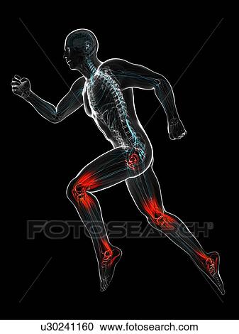 Running injuries, conceptual artwork View Large Illustration Clipart - Running injuries, conceptual artwork. Fotosearch