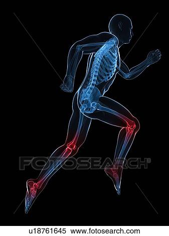 Running injuries, conceptual artwork View Large Illustration Stock Illustration - Running injuries, conceptual artwork. Fotosearch