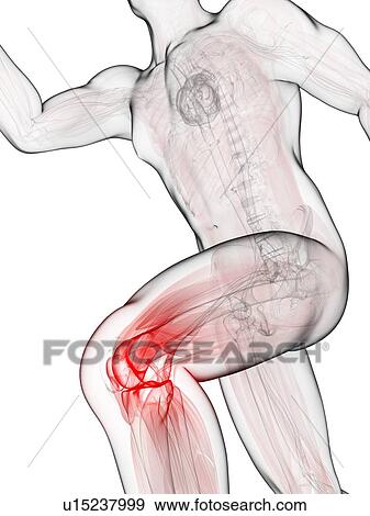 Running injury, conceptual artwork View Large Illustration Stock Illustration - Running injury, conceptual artwork. Fotosearch