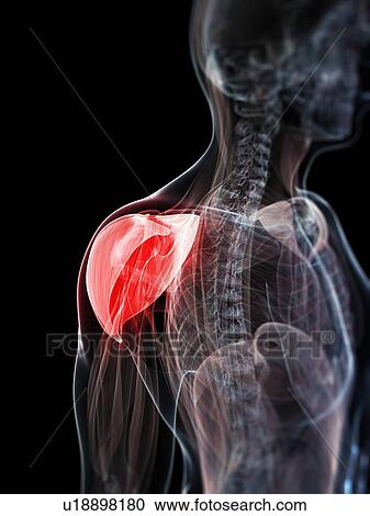 Shoulder pain, conceptual artwork View Large Illustration Clipart - Shoulder pain, conceptual artwork. Fotosearch